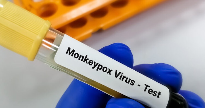 Alerte mondiale contre le Mpox ou la variole du singe